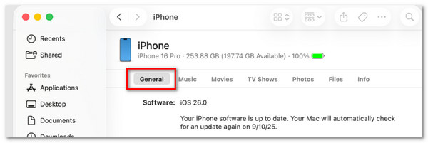 Click General Button